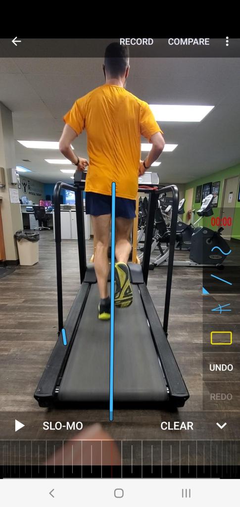 after gait corrections posterior view